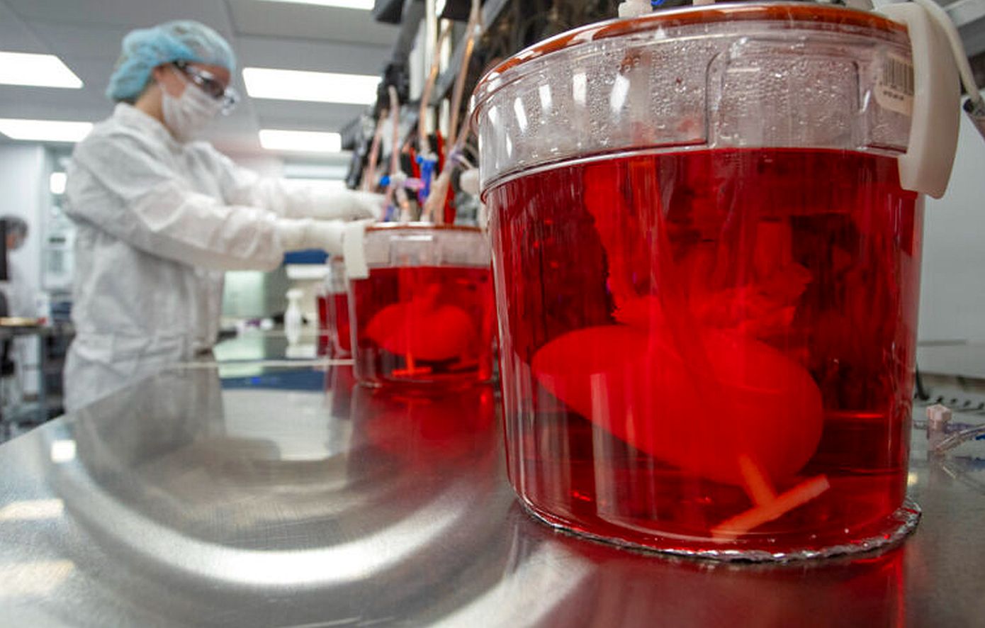 ΗΠΑ: Πέθανε ο πρώτος ασθενής που είχε κάνει μεταμόσχευση νεφρού από από γενετικά τροποποιημένο χοίρο