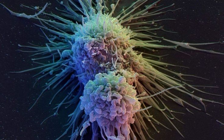 Πώς «γεννιέται» ο καρκίνος: Επιστήμονες αναζητούν στοιχεία