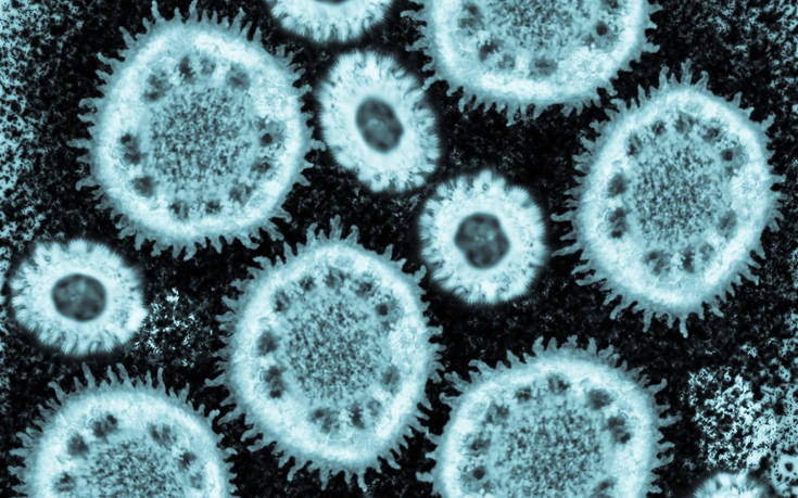 Όσα πρέπει να ξέρουμε για τον κοροναϊό: Η μεταδοτικότητα και η μεγάλη ομοιότητα με τον ιό των νυχτερίδων
