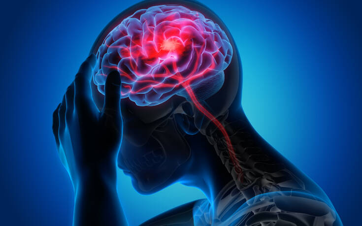 Η «covid μακράς διαρκείας» πλήττει τον εγκέφαλο αλλά και πολλά όργανα του σώματος